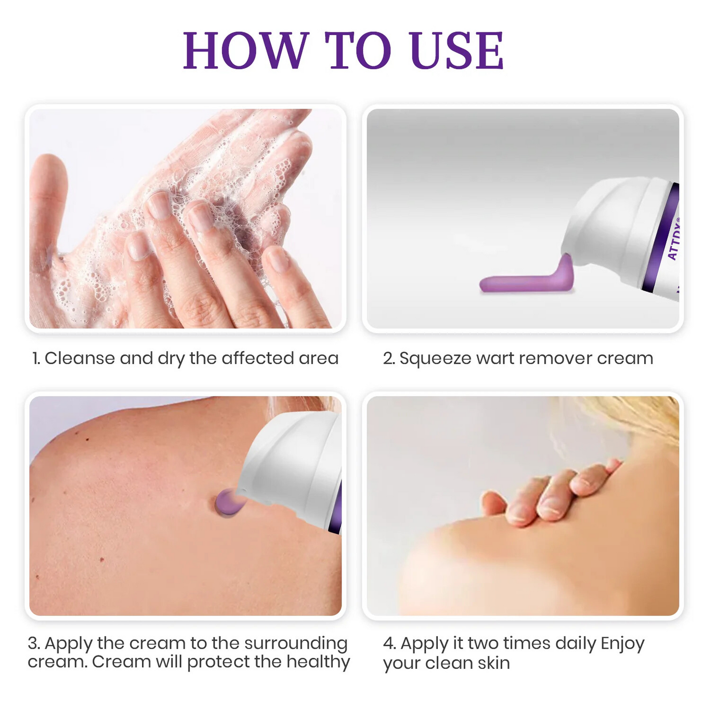 ATTDX® Instant Mole & Spot NatureStore Cream