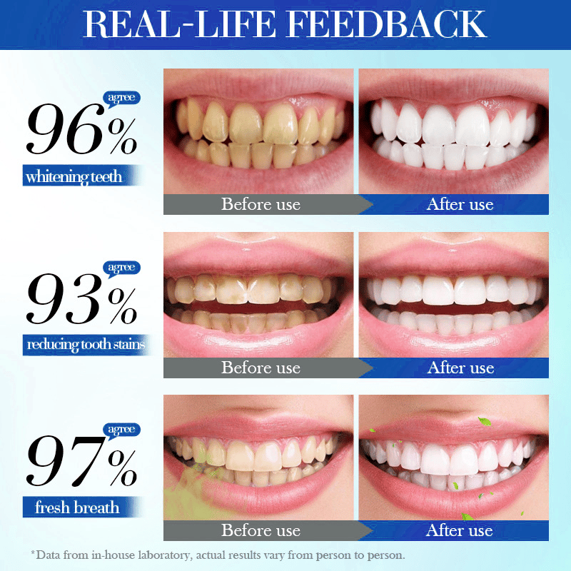 Beamach Hydroxyapatite Toothpaste 7.5% for Enamel Repair & Teeth Whitening Refreshing Flavor Fluorid