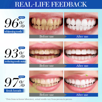 Beamach Hydroxyapatite Toothpaste 7.5% for Enamel Repair & Teeth Whitening Refreshing Flavor Fluorid