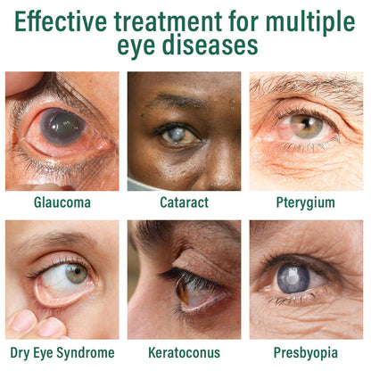 👩‍⚕️LOVILDS™ Nano Eye Drops Serum ✅FDA Approved(Suitable for presbyopia, dry eye syndrome, glaucoma, and cataracts) 👀