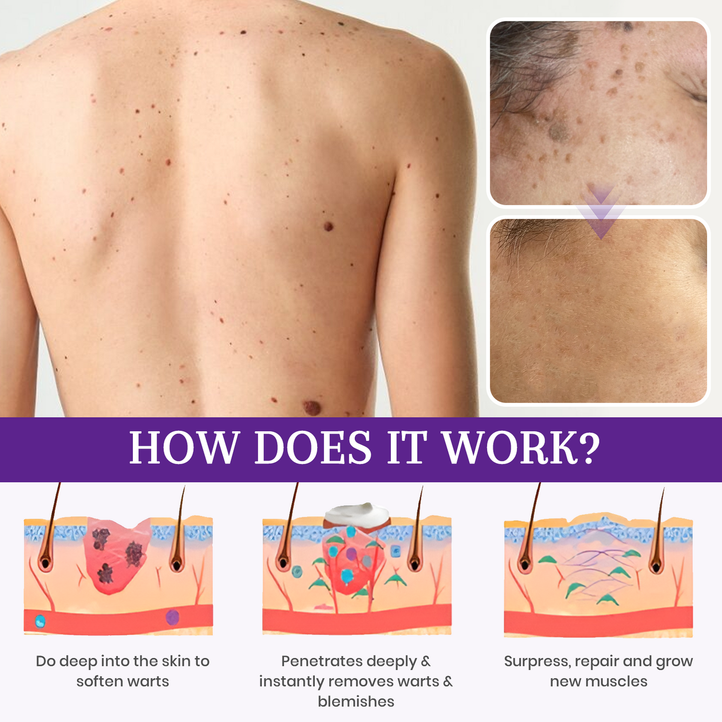 ATTDX® Instant Mole & Spot NatureStore Cream